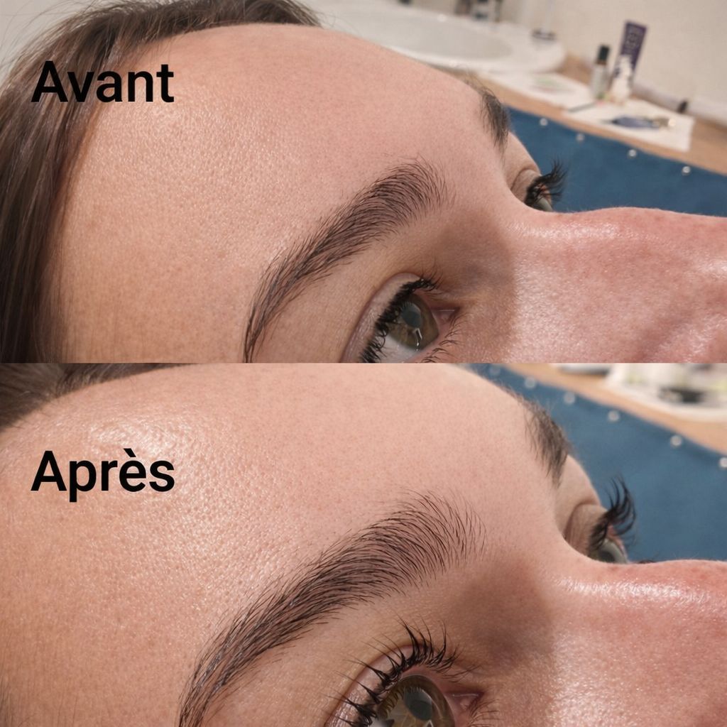 Soin visage